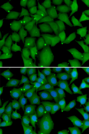 Anti-BCL2L15 Antibody (CAB7156)