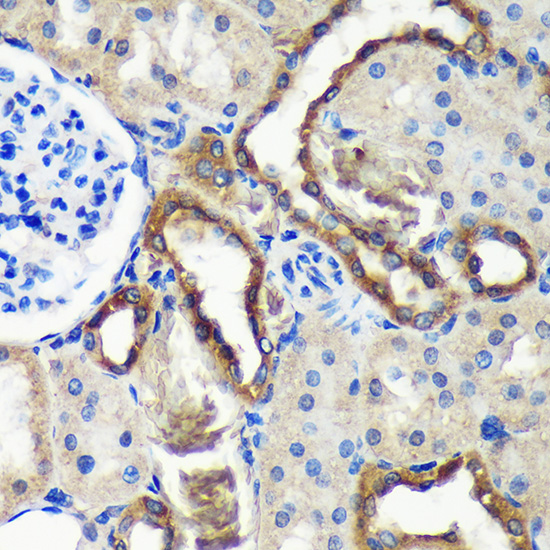 Anti-C18orf8 Antibody (CAB15825)