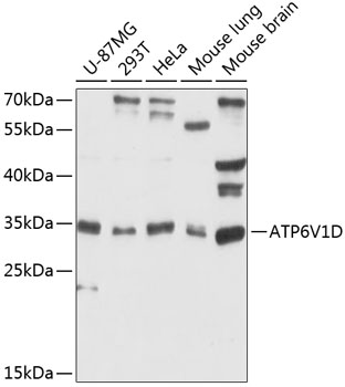 Anti-ATP6V1D Antibody (CAB12940)