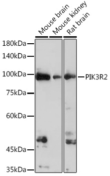 Anti-PIK3R2 Antibody (CAB17433)