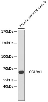 Anti-COL9A1 Antibody (CAB6563)