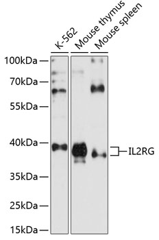 Anti-IL-2RG Antibody (CAB1829)