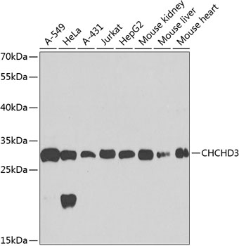 Anti-CHCHD3 Polyclonal Antibody (CAB8584)