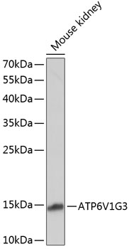 Anti-ATP6V1G3 Antibody (CAB14443)