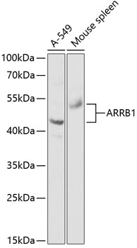 Anti-ARRB1 Antibody (CAB0190)
