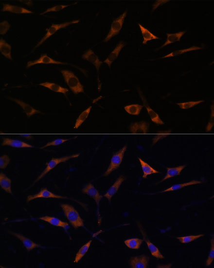 Anti-RPL28 Antibody (CAB15095)