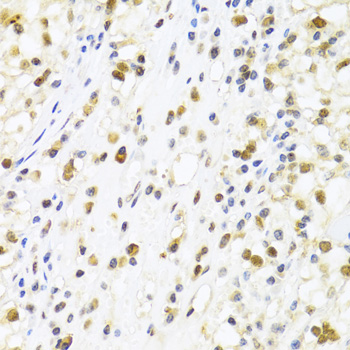 Anti-SUMO4 Antibody (CAB3100)