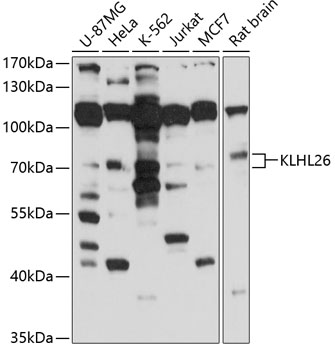 Anti-KLHL26 Antibody (CAB10374)