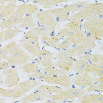 Anti-CXCR3 Antibody (CAB2939)