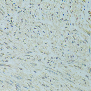 Anti-XBP1 Antibody (CAB14860)