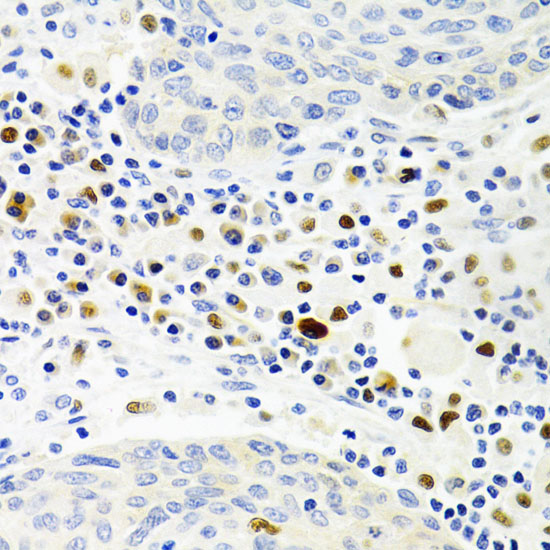 Anti-GEMIN2 Antibody (CAB3082)