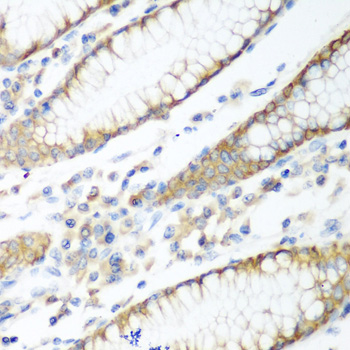 Anti-PTEN Antibody (CAB11189)