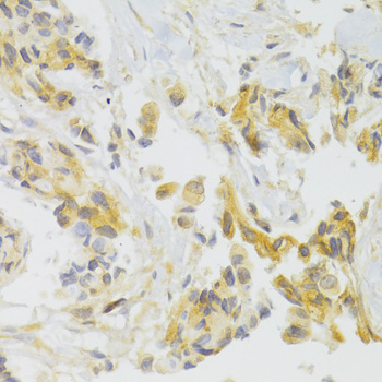 Anti-EIF4G1 Antibody (CAB7552)