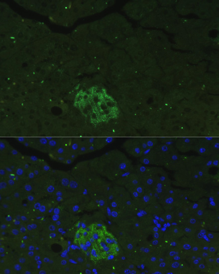 Anti-FAM3B Antibody (CAB1082)