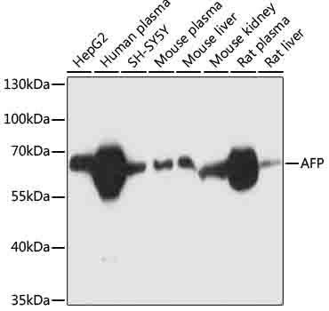 Anti-AFP Mouse Monoclonal Antibody (CAB11865)