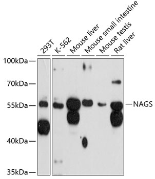 Anti-NAGS Antibody (CAB12086)