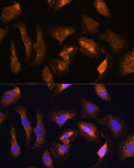 Anti-RPS17 Antibody (CAB16426)