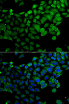 Anti-SYNCRIP Antibody (CAB7219)