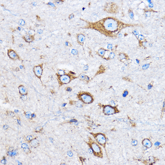 Anti-CTSB Antibody (CAB0967)