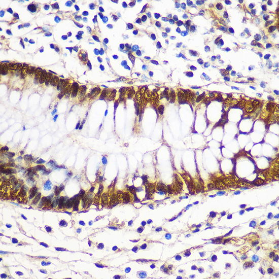 Anti-YWHAG Antibody (CAB3043)