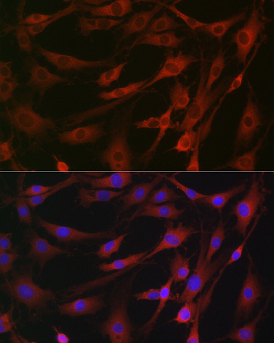 Anti-MLKL Antibody (CAB17312)