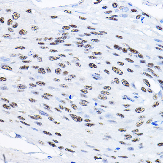 Anti-SMEK1 Polyclonal Antibody (CAB8500)