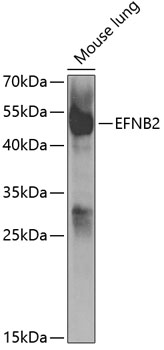 Anti-EFNB2 Antibody (CAB5669)