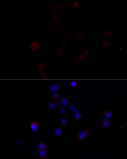 Anti-Caspase-3 Antibody (CAB11319)