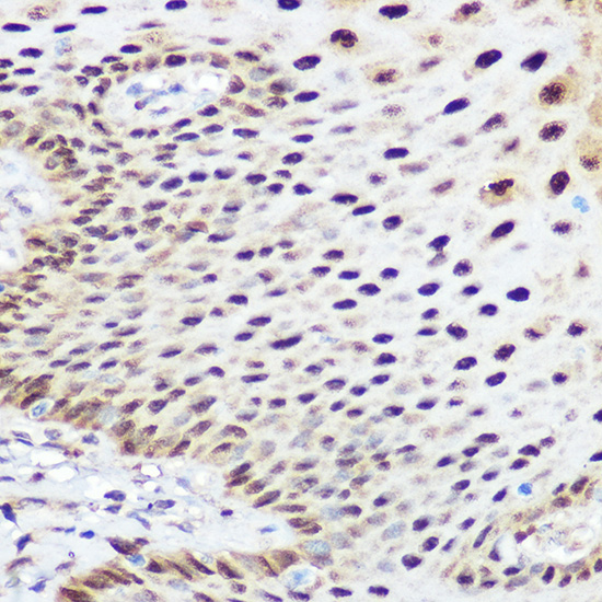 Anti-SOX2 Antibody [KO Validated] (CAB0561)