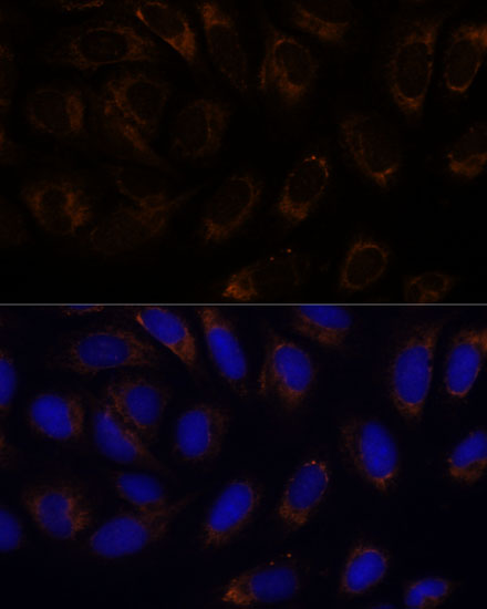 Anti-RAMP1 Antibody (CAB6447)