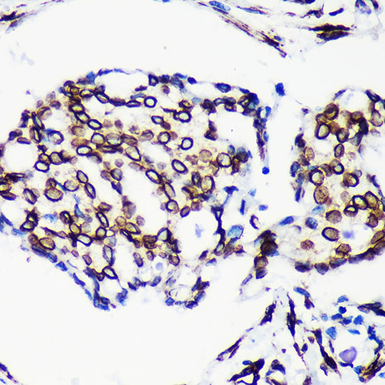 Anti-Lamin A/C Antibody [KO Validated] (CAB19524)