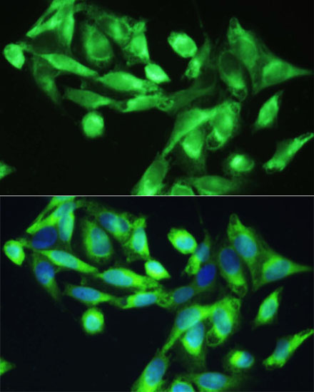 Anti-CXCR5 Antibody (CAB5268)