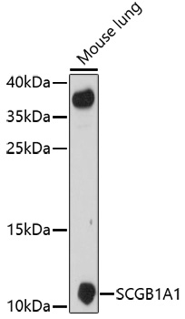 Anti-SCGB1A1 Antibody (CAB16997)