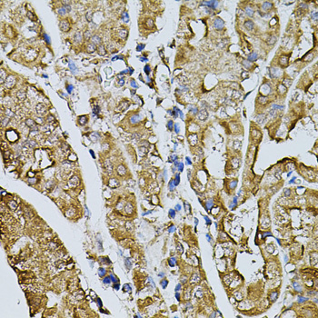 Anti-MYL1 Polyclonal Antibody (CAB8438)