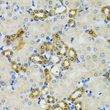 Anti-PHPT1 Antibody (CAB1127)