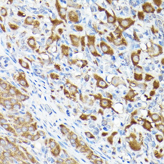 Anti-EEF1A1 Antibody (CAB17857)