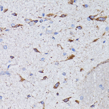 Anti-AVP Antibody (CAB1725)