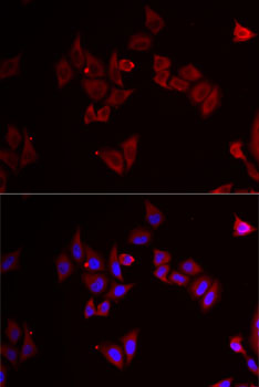 Anti-MAP2K5 Antibody (CAB6953)