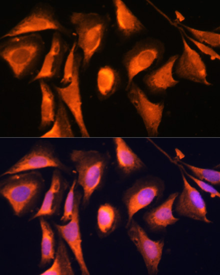 Anti-RAB21 Antibody (CAB12095)