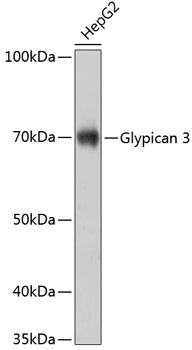 Anti-Glypican 3 Antibody