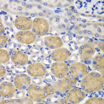 Anti-SND1 Antibody [KO Validated] (CAB13415)