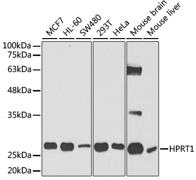 Anti-HPRT1 Antibody [KO Validated] (CAB5692)