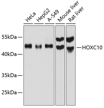 Anti-HOXC10 Antibody (CAB12215)