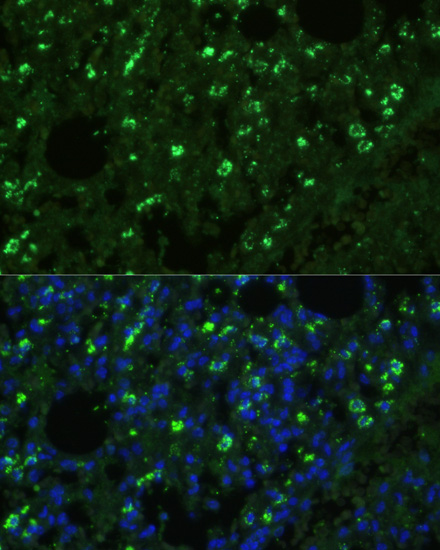 Anti-TREM2 Antibody (CAB10482)