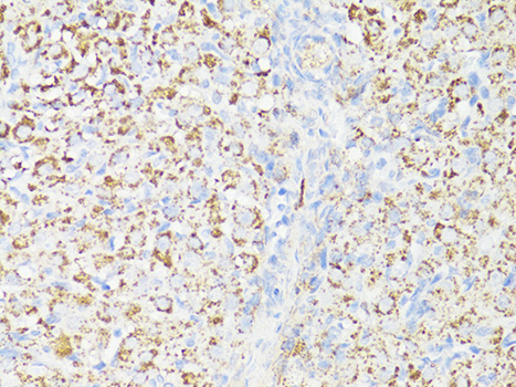 Anti-mTOR Antibody (CAB11354)