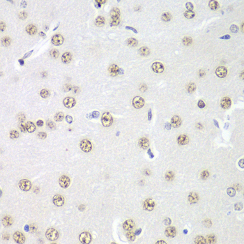 Anti-PRMT5 Antibody (CAB1520)