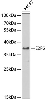 Anti-E2F6 Antibody (CAB2718)