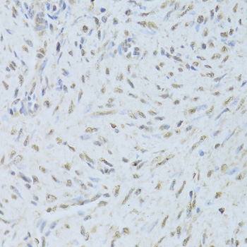 Anti-TARDBP Antibody (CAB1183)