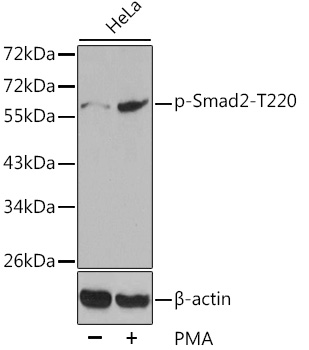 Anti-Phospho-SMAD2-T220 Antibody (CABP0270)