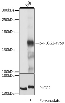 Anti-Phospho-PLCG2-Y759 pAb (CABP0785)